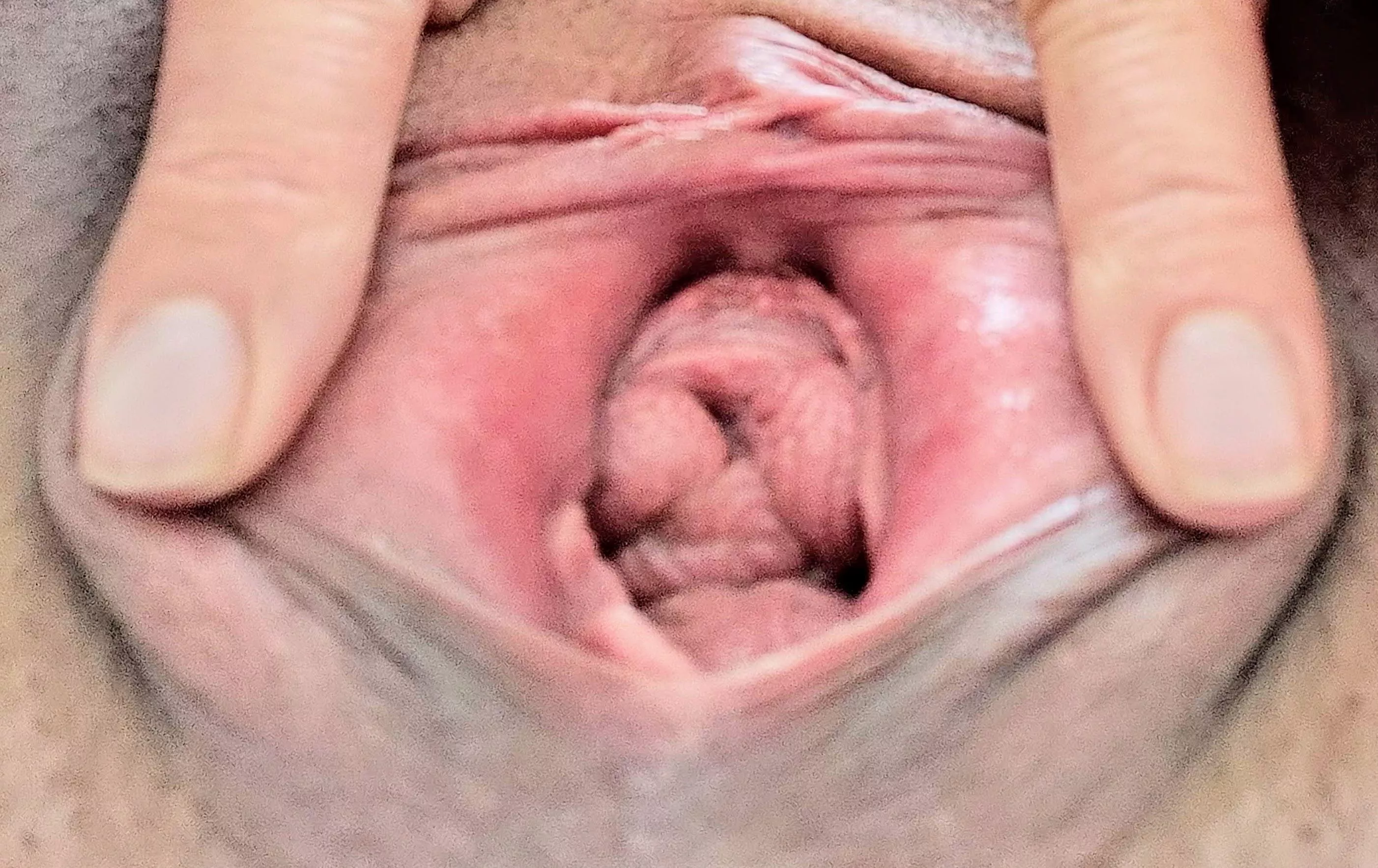 🐱 posted by Snoo-90330