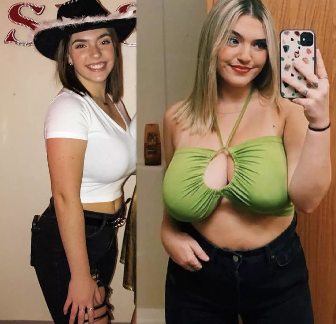 11 month breast growth posted by questt43