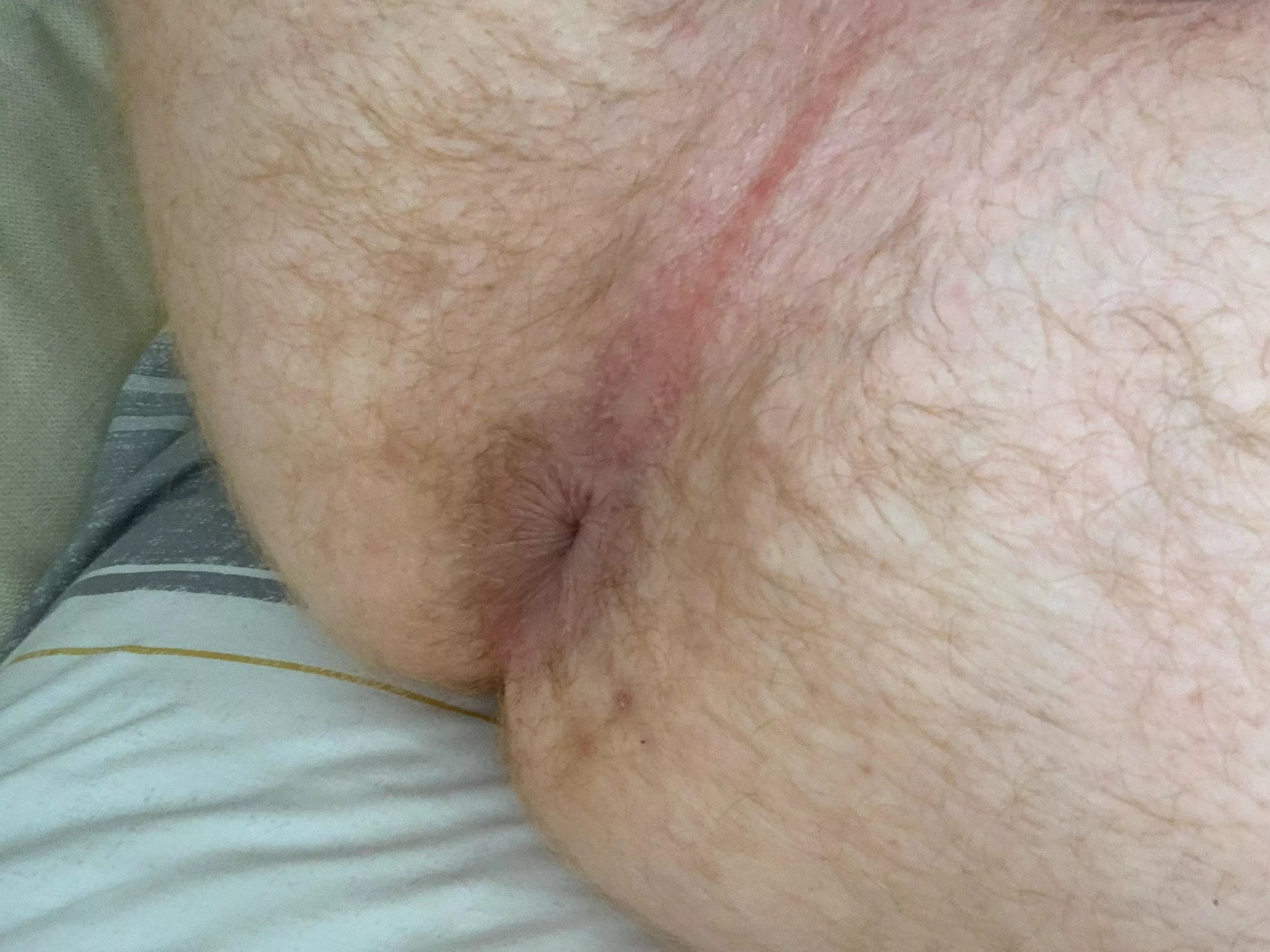 18 ginger like my hairy hole posted by crazy_teen1