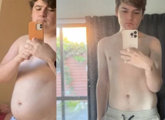 19 y/o. Before and After 50 pounds weight loss by RockyHorror02