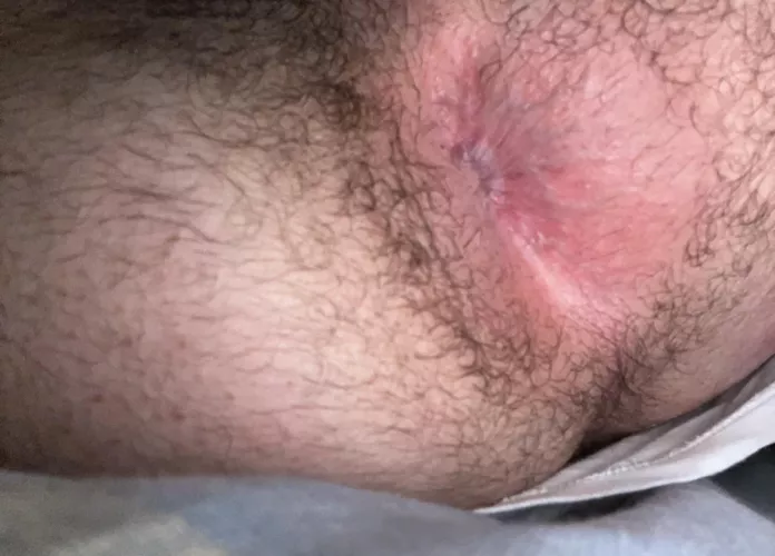 (21) 🍑 by Misterhidden0