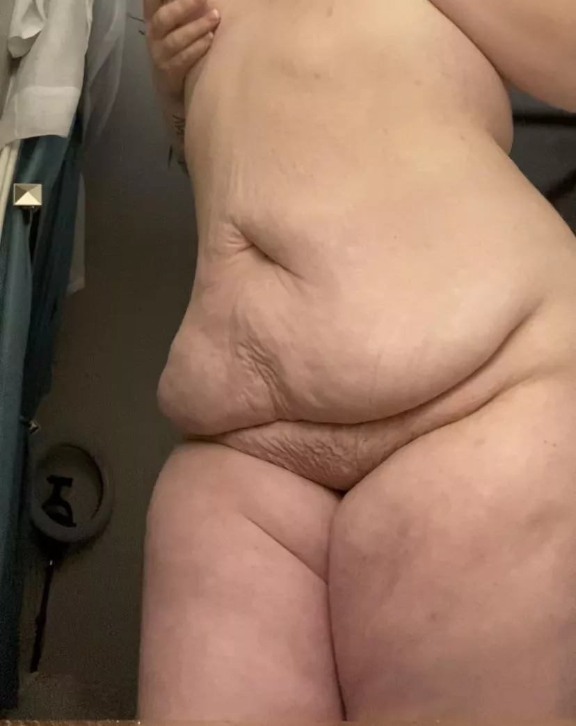 25•195 lbs•5”6 Was finally feeling confident with other parts of my body but this really gets me every time. Makes me scared to take my clothes off around anyone. posted by PretendMongoose9113