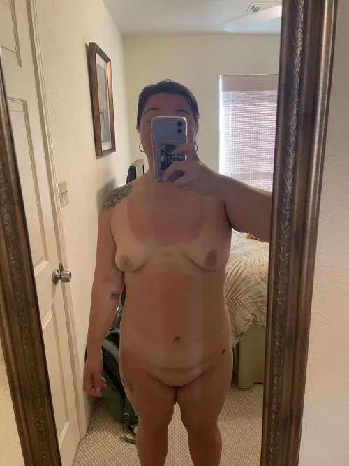 34F, 195 lbs, 5’5” — sunburn every year 😤 by RepresentativeSky613