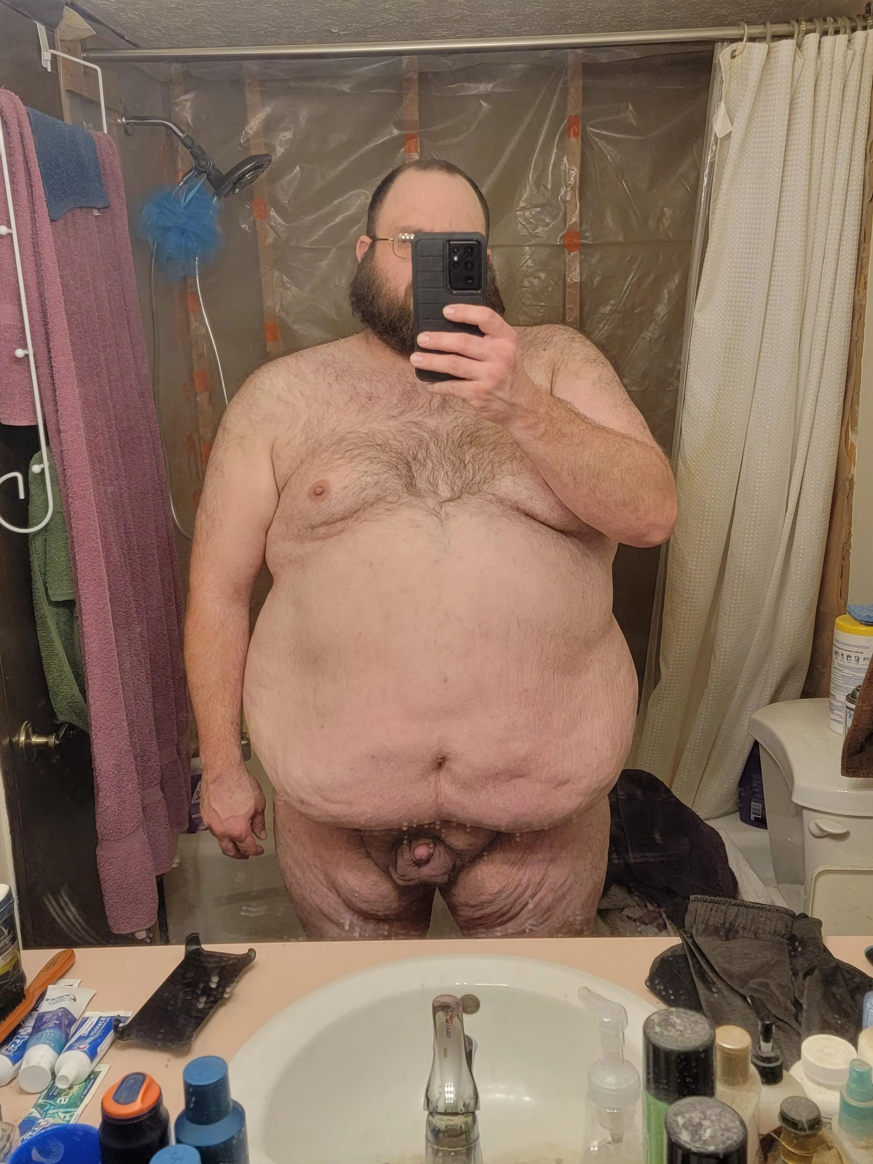 35, M, 6ft, 395lbs. Very insecure about my body. Feel like I'm not attractive enough for anyone posted by huntersdad62609