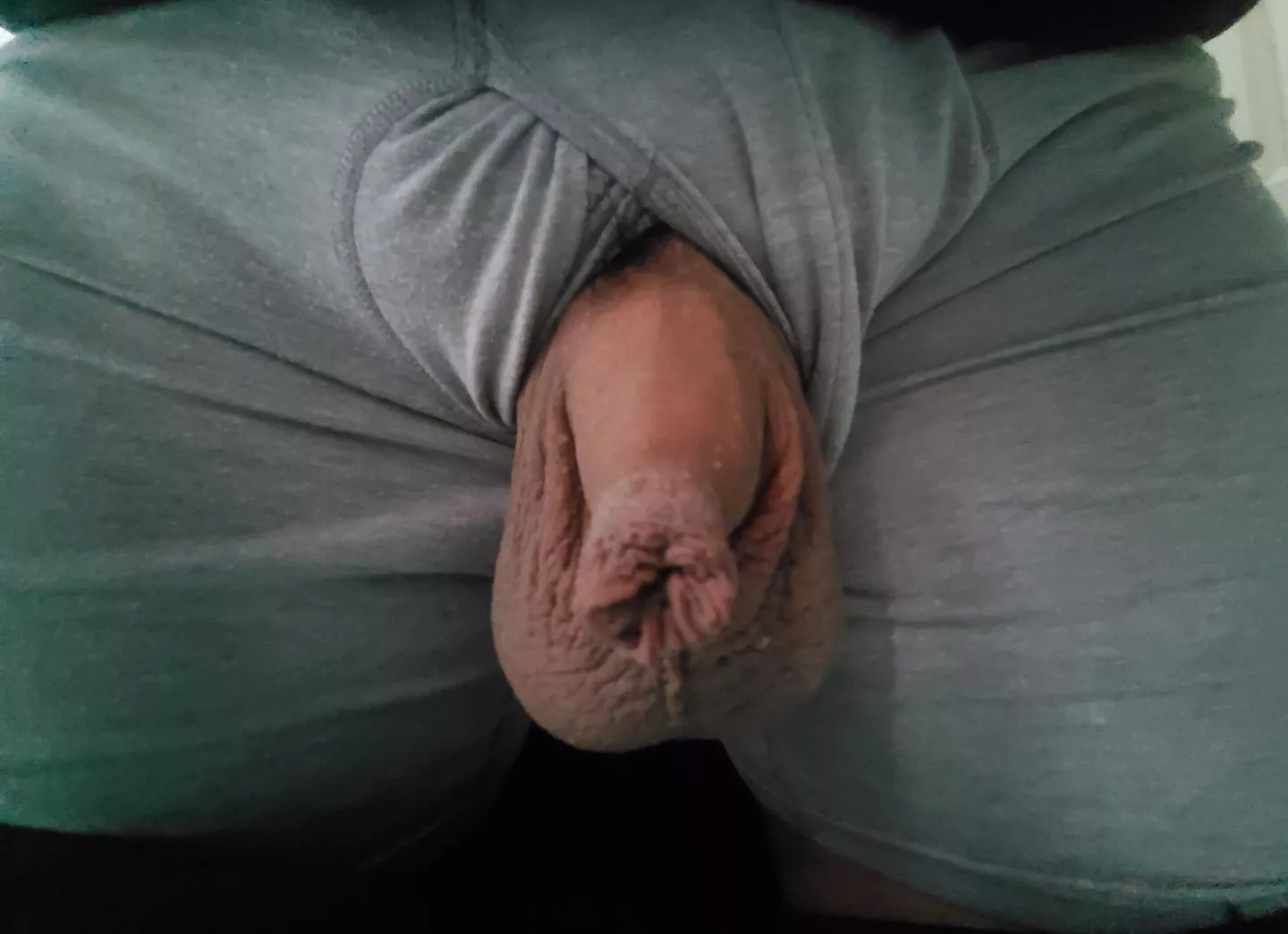 [41] Some foreskin action for those that like uncut and basically my name here. 😉 posted by BigSackSmallCack