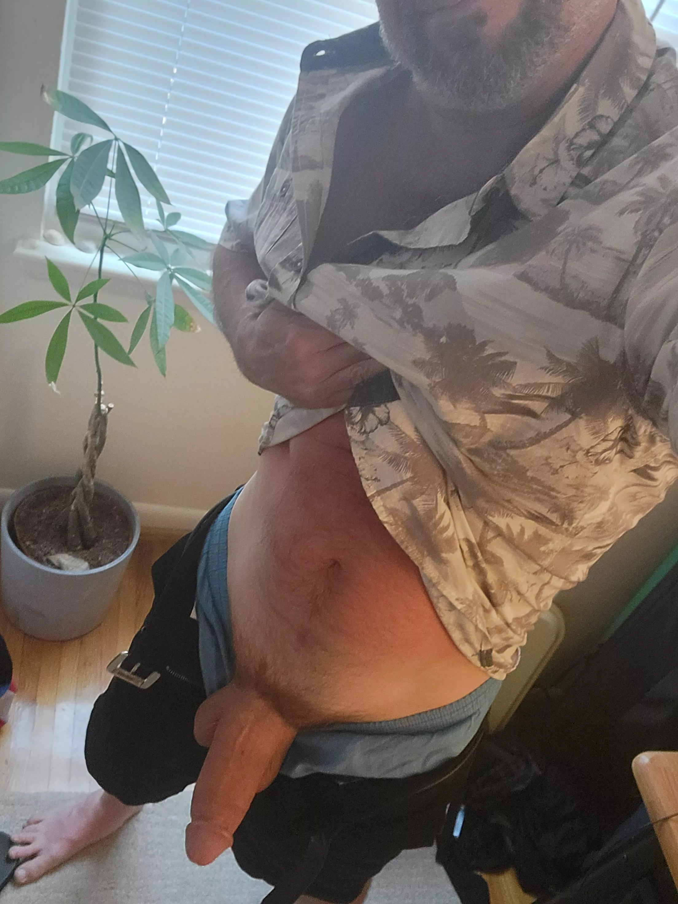 [51][OC] the sunburn is still 🔥 posted by brady_mcshady