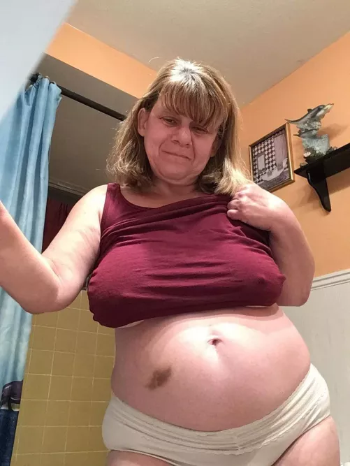 59 I fell and got a boo-boo someone kiss it and make it better by Front-Pea3685