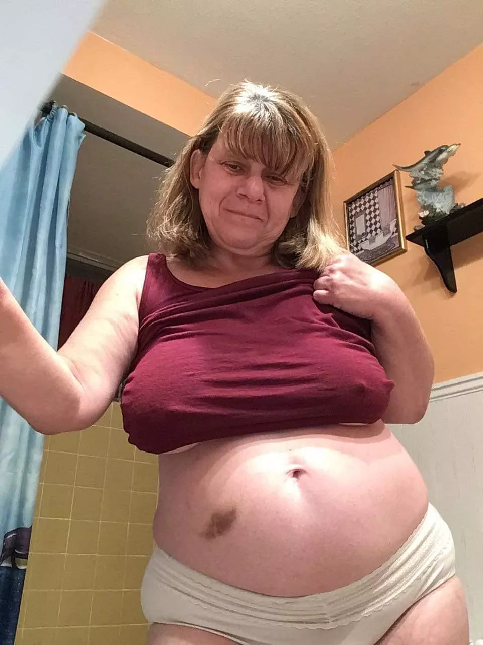 59 I fell and got a boo-boo someone kiss it and make it better posted by Front-Pea3685