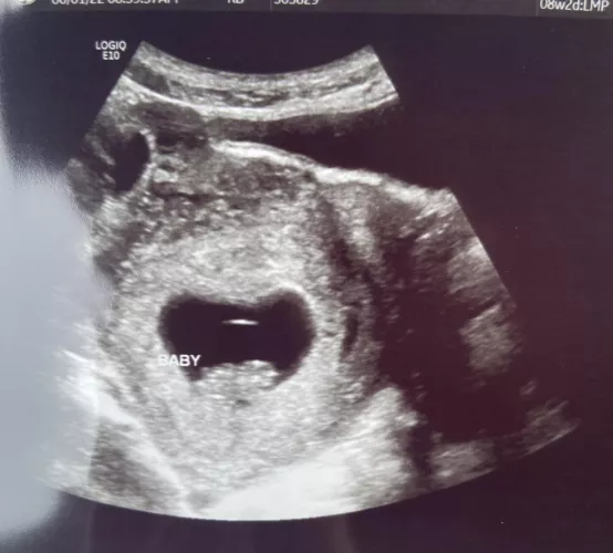 9 weeks now. One proud cucky daddy here as she’s out getting more of what created this little miracle with the man that gave it to her. 🥰 by Acceptable-Ad1852