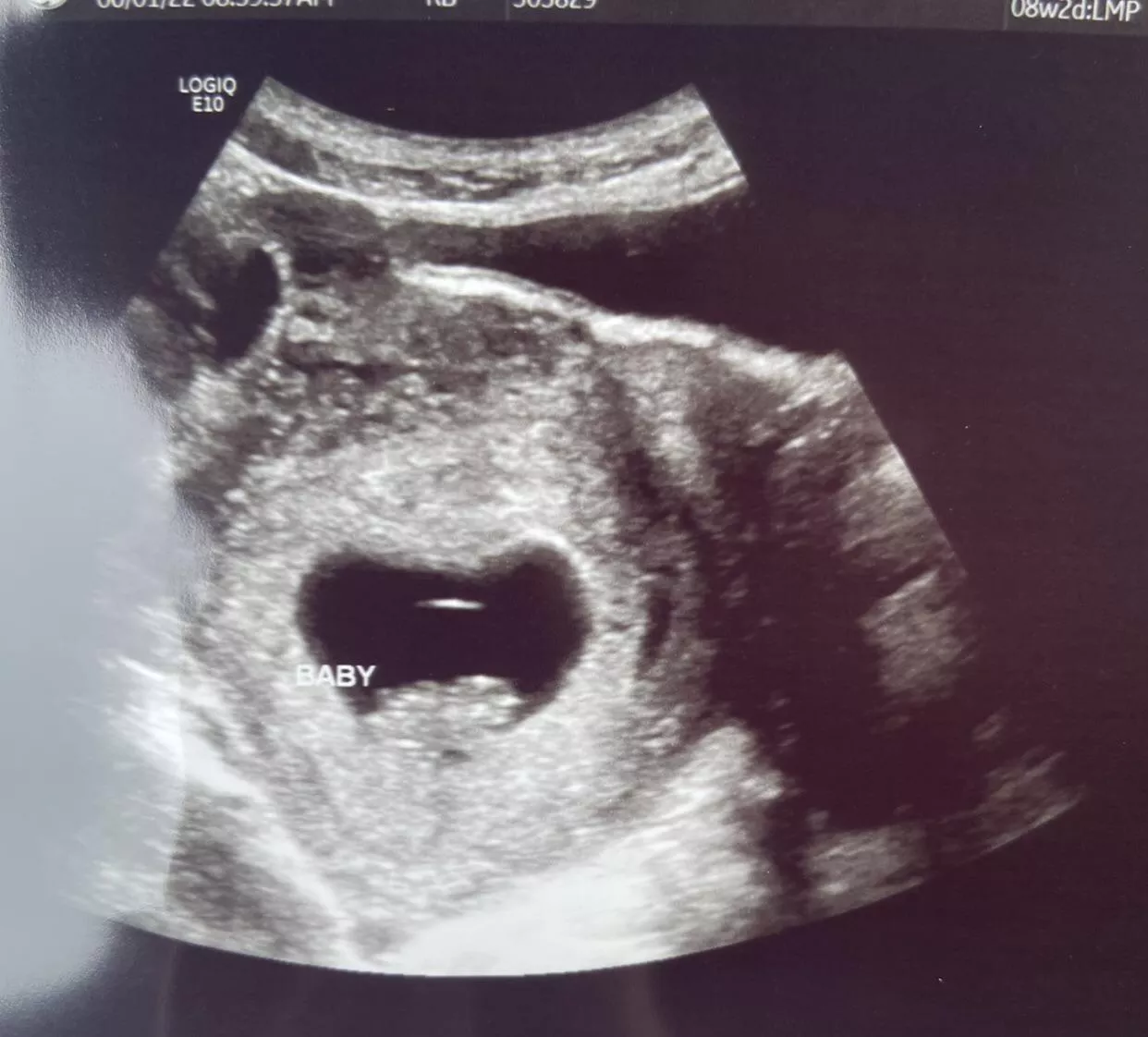 9 weeks now. One proud cucky daddy here as she’s out getting more of what created this little miracle with the man that gave it to her. 🥰 posted by Acceptable-Ad1852