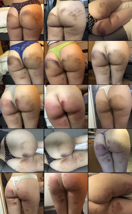 A compilation [F]rom when I actually used to bruise easily 😭😍 by SalazarsBrain