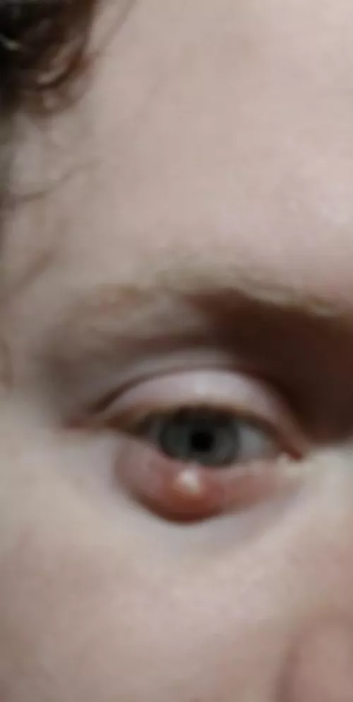 A forbidden eye pop from my friend by nayaya