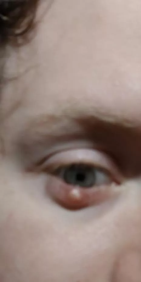 A forbidden eye pop from my friend posted by nayaya