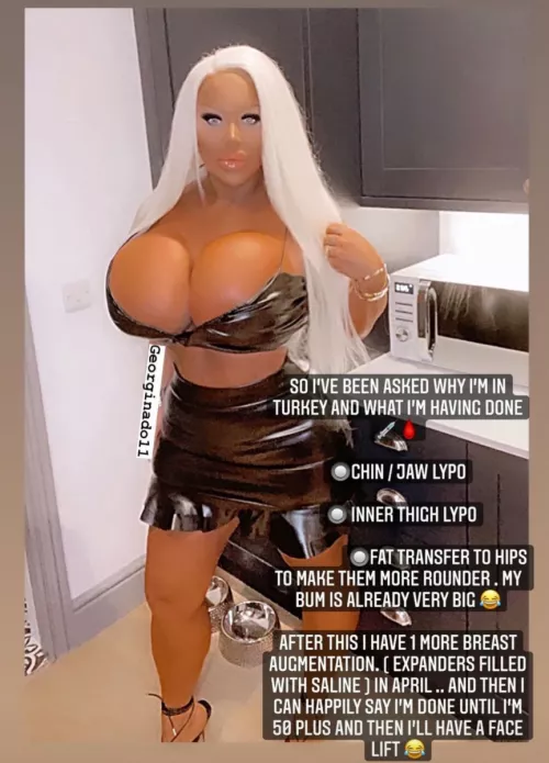 A good bimbo is proud of her surgery by burger_boyuk