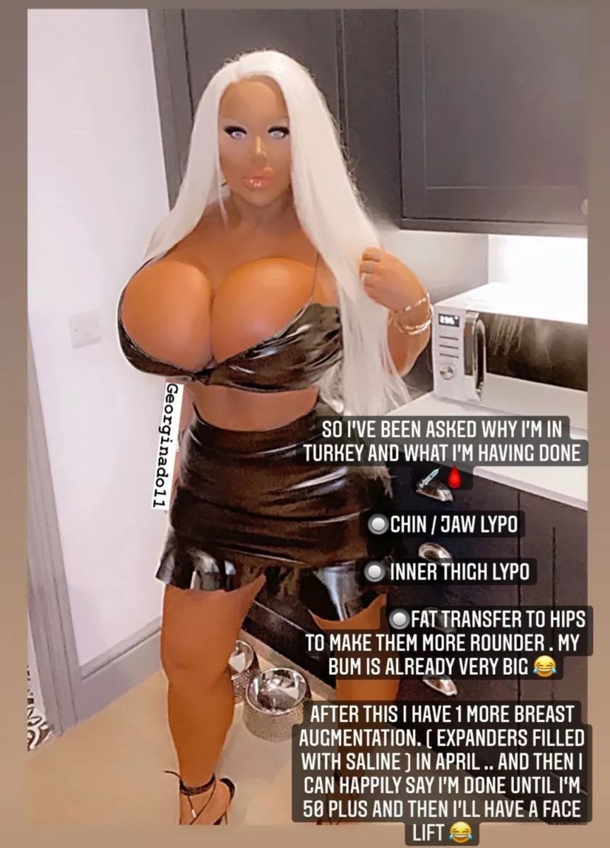 A good bimbo is proud of her surgery posted by burger_boyuk