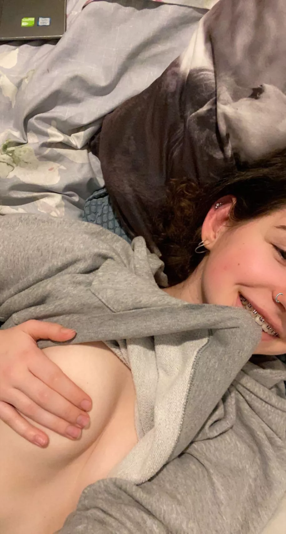 A legal teen with braces here😇 posted by RitaFiore