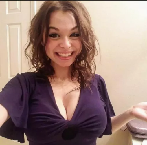 a nice smile can draw some of the attention away from them by Charming-Track1747