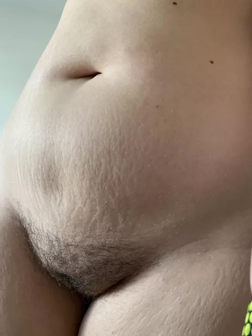 A unfiltered lower stomach after 70lbs weight loss since last year around this time. F21 5’11” SW:275 Today:205ish by religiousbirk