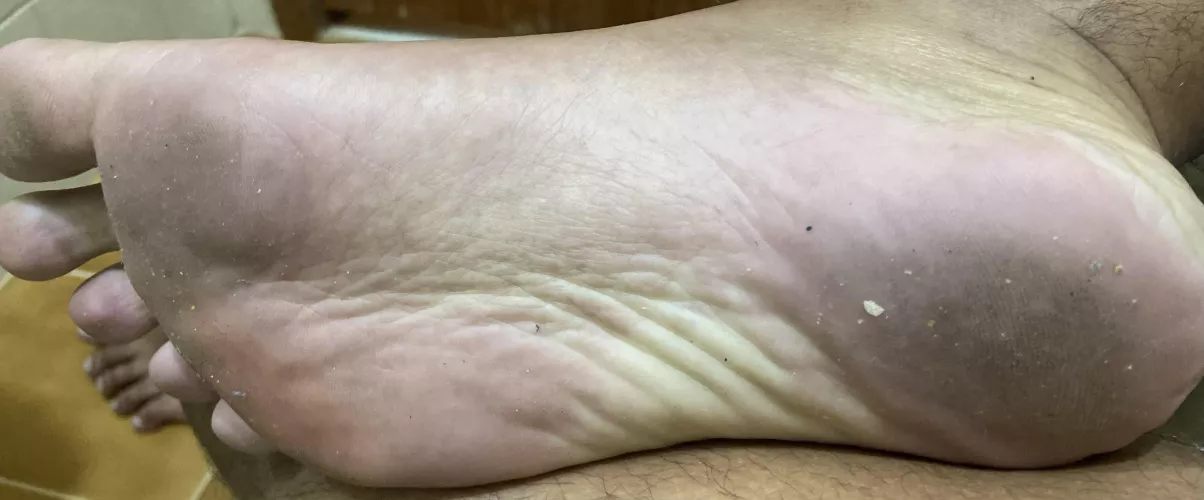 After 24 hours barefoot, dirty enough? If you want to lick or come on those dirty soles, you can 😜 by Lower-Entry-8918