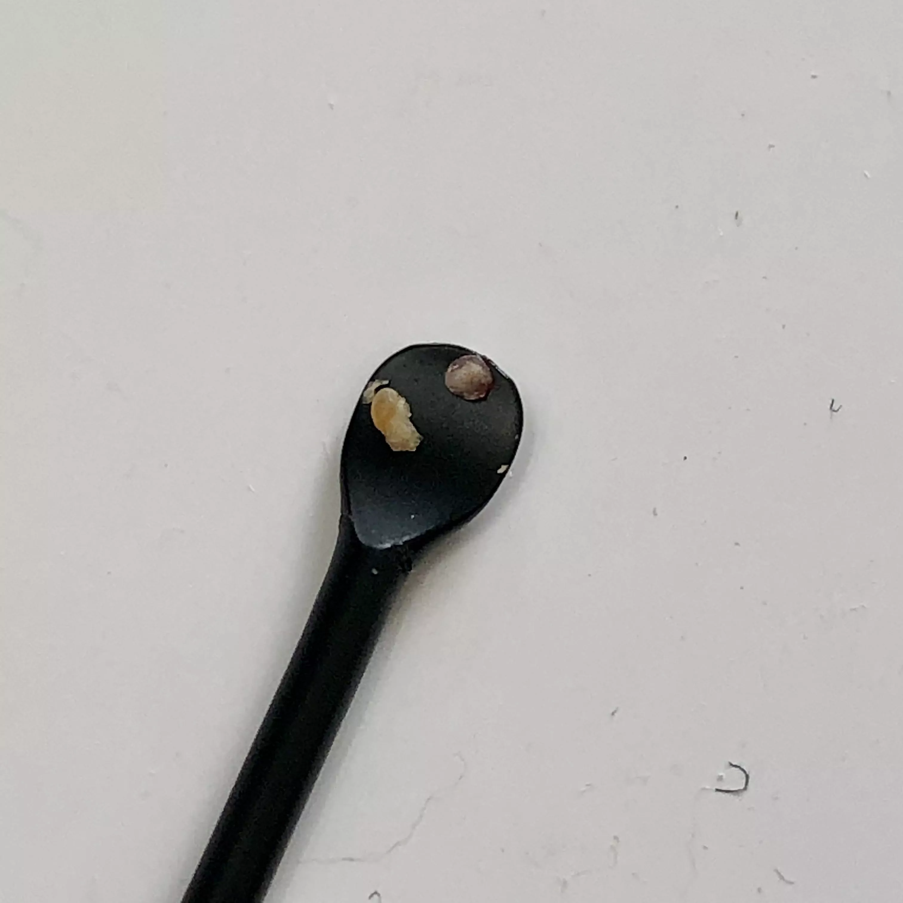 After 8 years, a milia on my eyelid suddenly came to a head. Look at all the gunk! posted by munchietrifecta