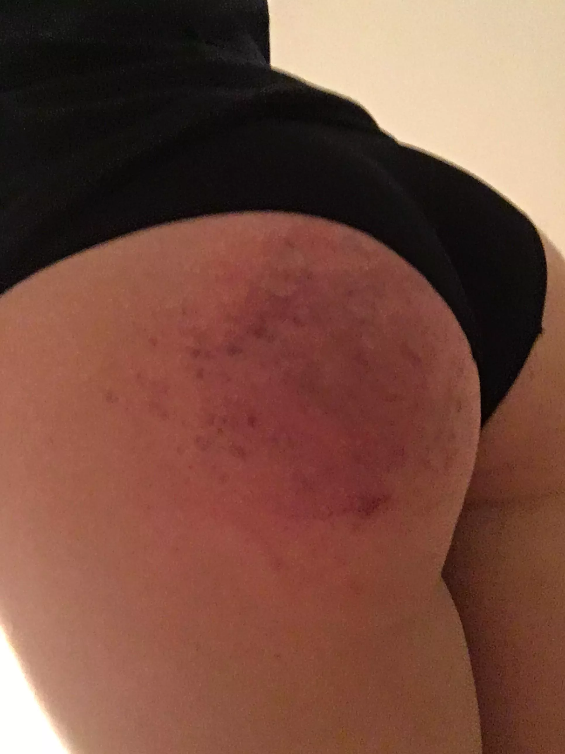 After the storm. posted by Spider135