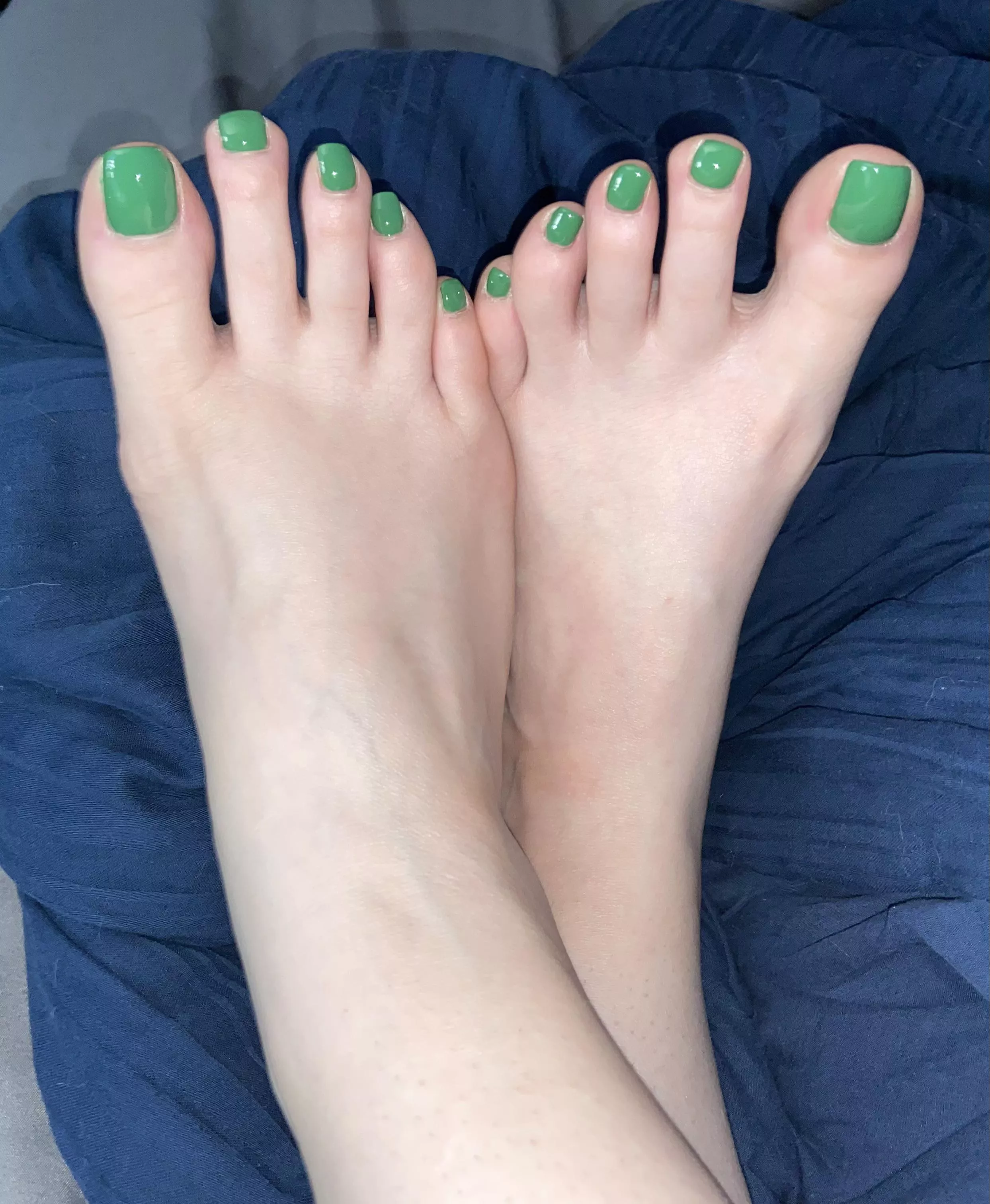 All ten of my toes need attention now posted by RabbitPaws194