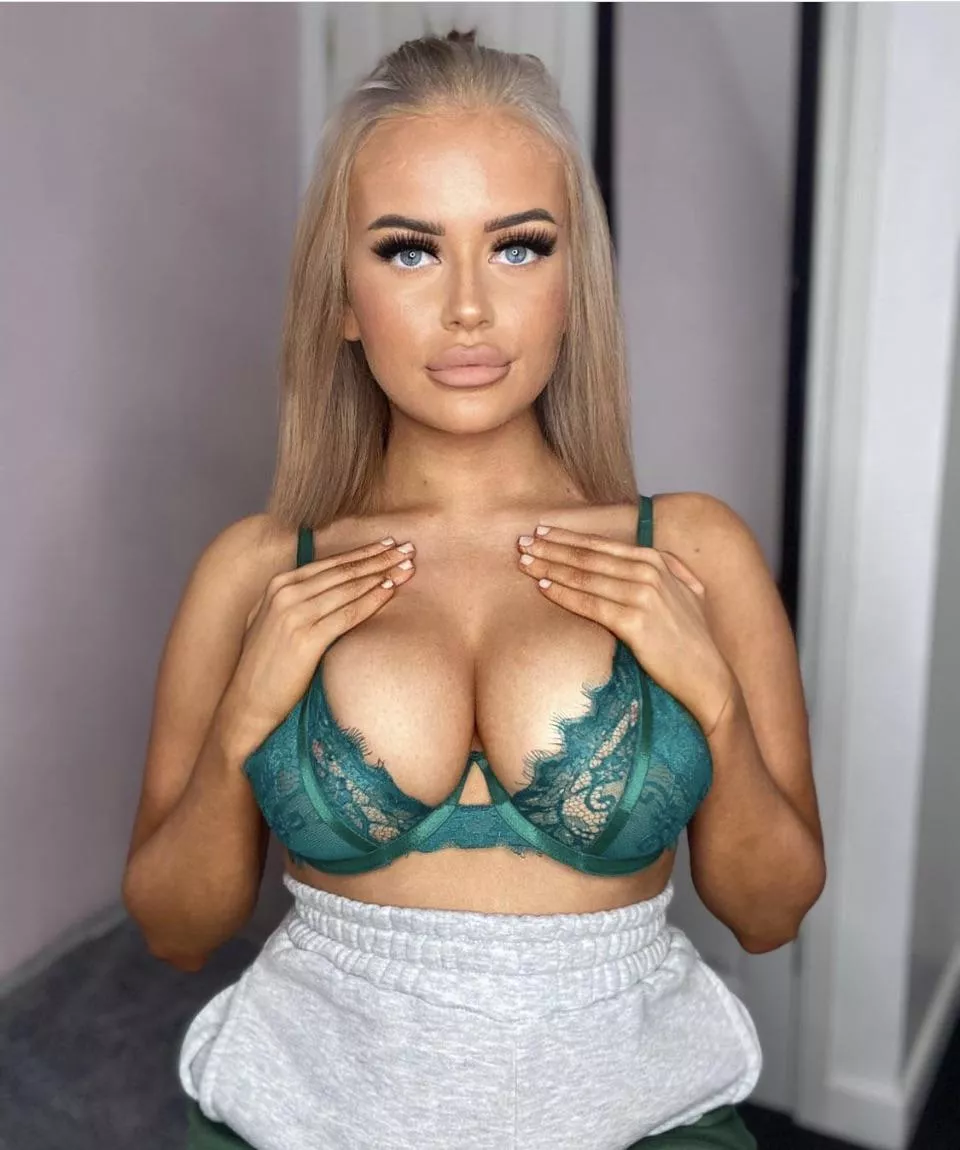 Amy posted by Healthy_Throat_9251