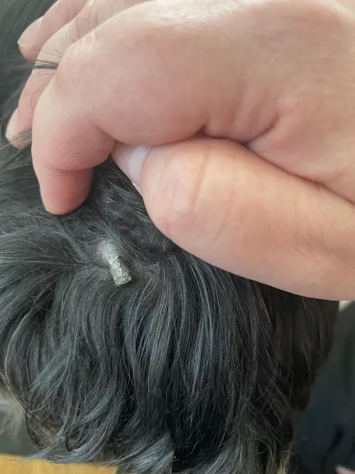 An old blackhead on old dog… popped it months ago and it must have popped out again. It’s too hard to remove on its own this time. by Secretpopsayshi