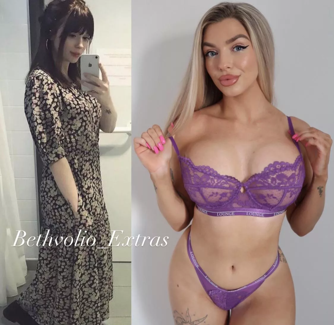 Another little update from me. Due to get more Botox and filler next week 🥰 posted by Bethvolio_extras