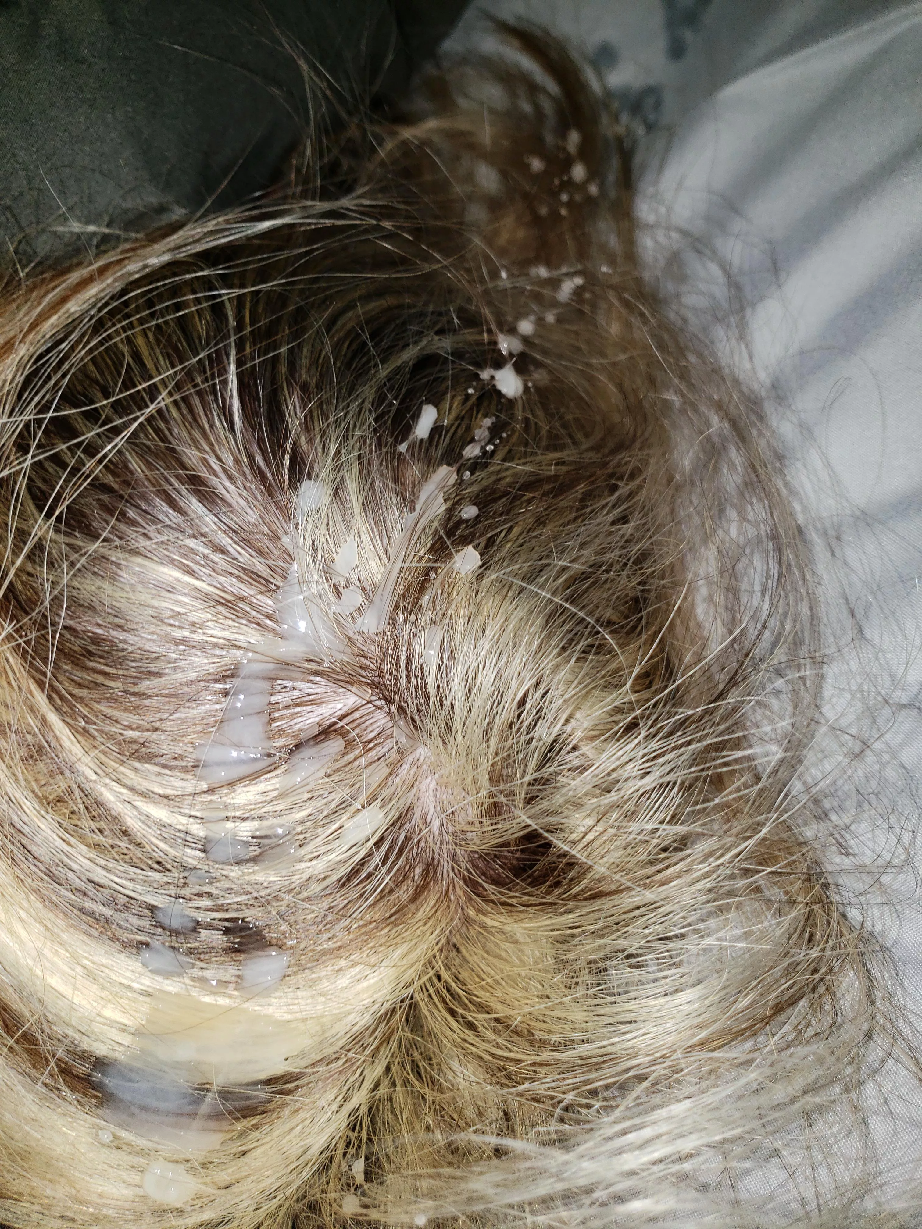 Another one of my hair getting ruined while im asleep...🥵🤩 posted by sharingstone