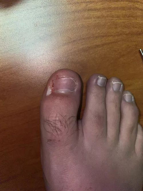 Another painful sharktooth by ed69696969