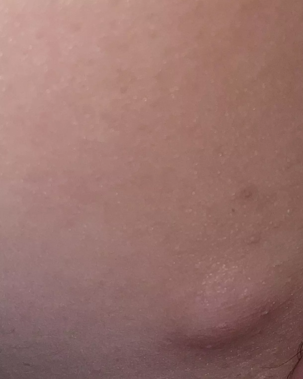 Any idea what this is? I’ve been to the doctor about two years ago and she said it felt okay. It’s got bigger since and hurts more. It’s on the inner side of my groin/leg. posted by whisperingocean