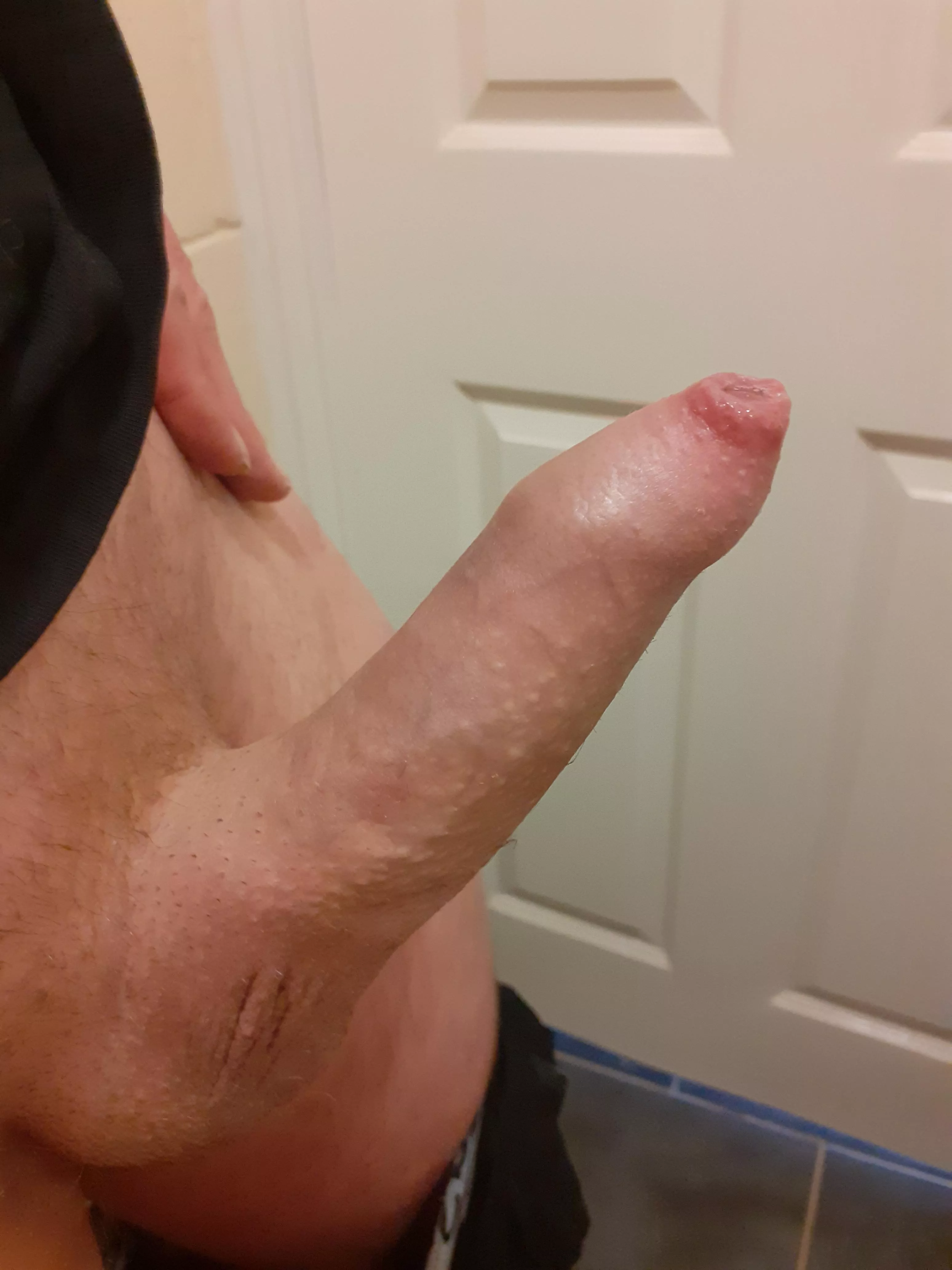 Any love for a tight foreskin (31) posted by Ok-Capital-548