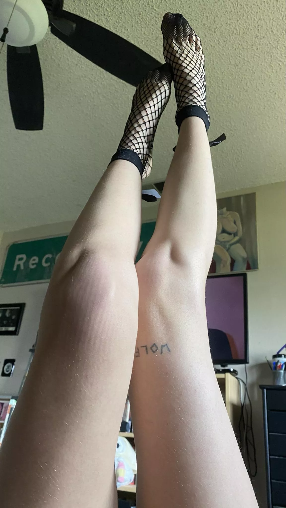 Anybody here looking for some skinny legs? :D posted by quarantinevagene