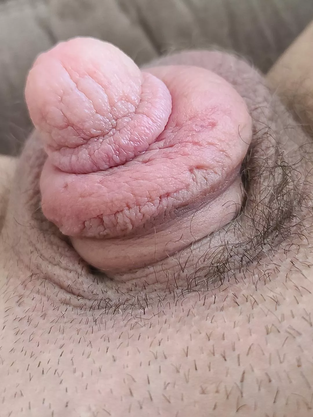 Anyone else get a wrinkled head after a pumping session? Should I be concerned? posted by robohardon