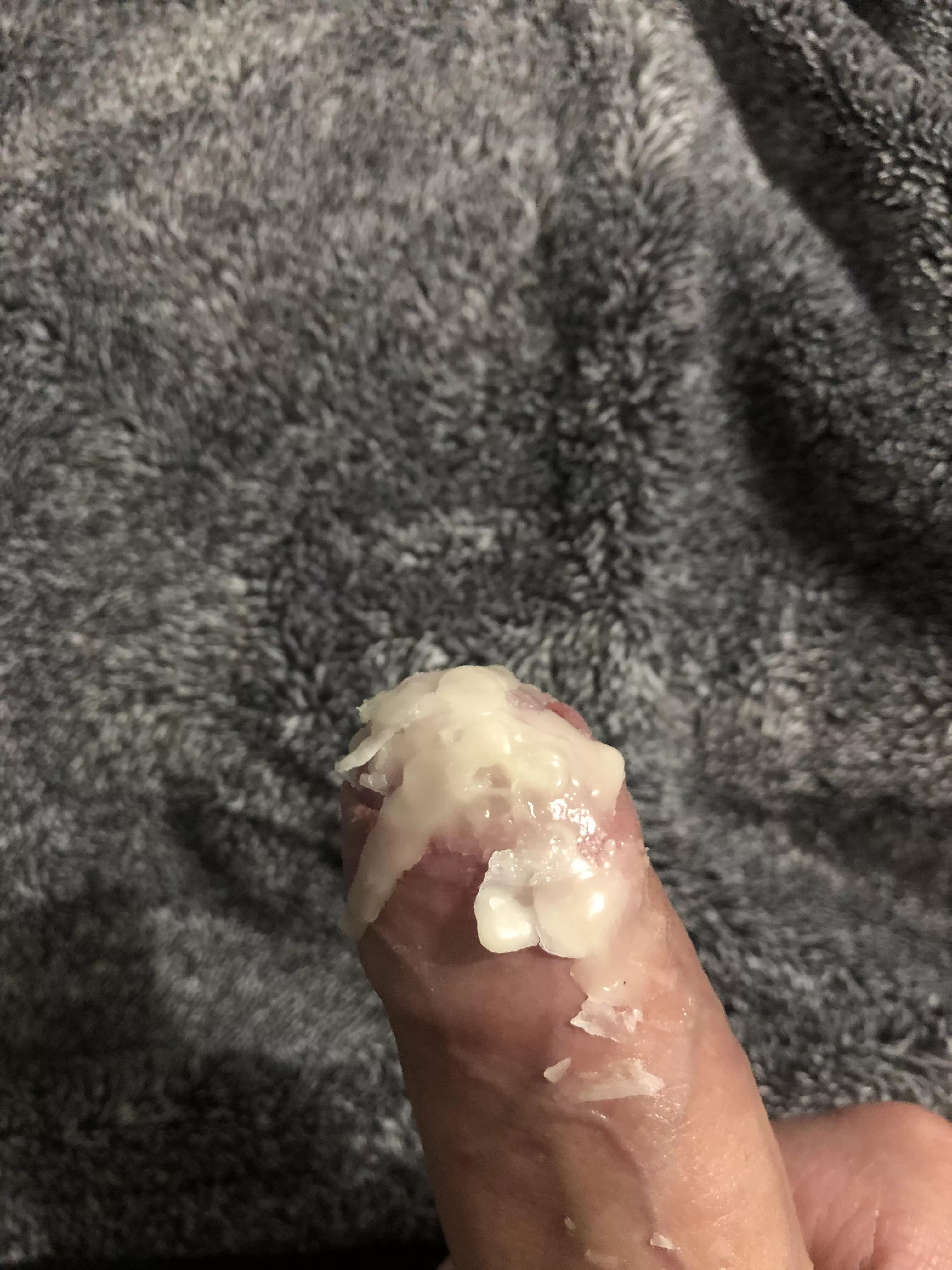 anyone else want to give me painful tasks, i’m open to anything posted by Fit-Pepper-527