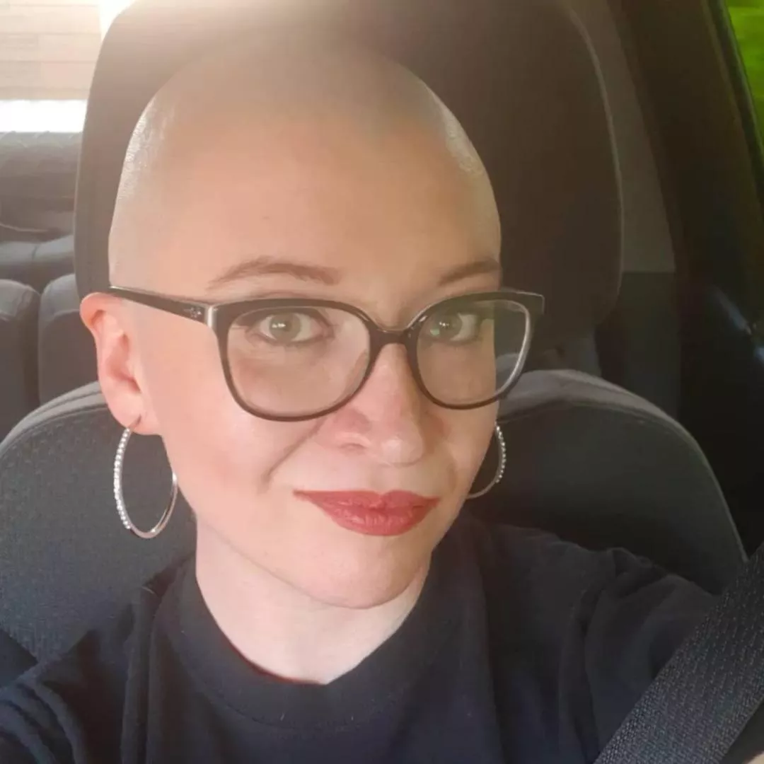 Anyone like bald girls? 🤔 HMU for customs 👀 by Key-Lynx5725