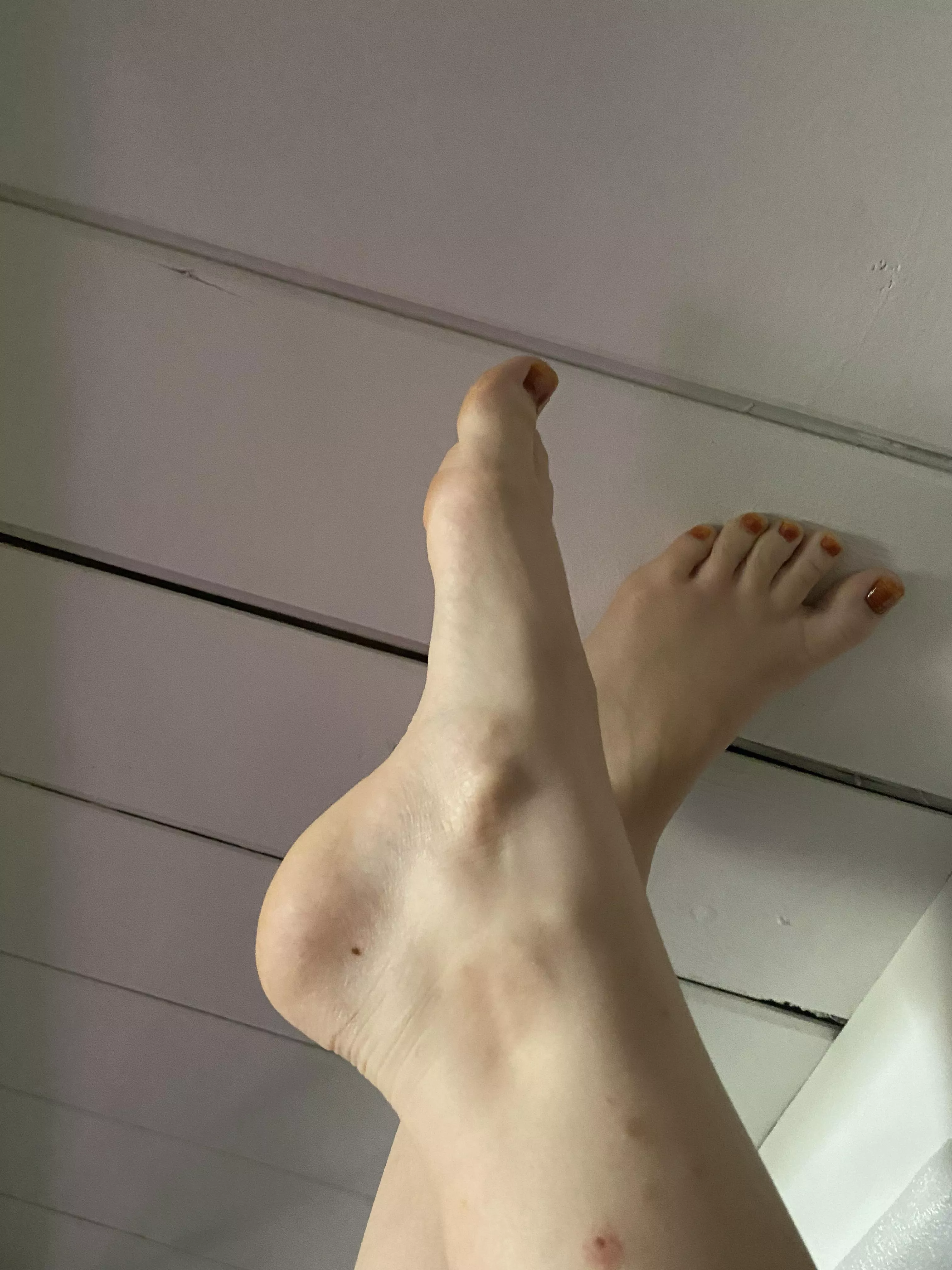 Are the Extra bones in my feet sexy? Genuine curiosity? posted by Old_Associate_1464