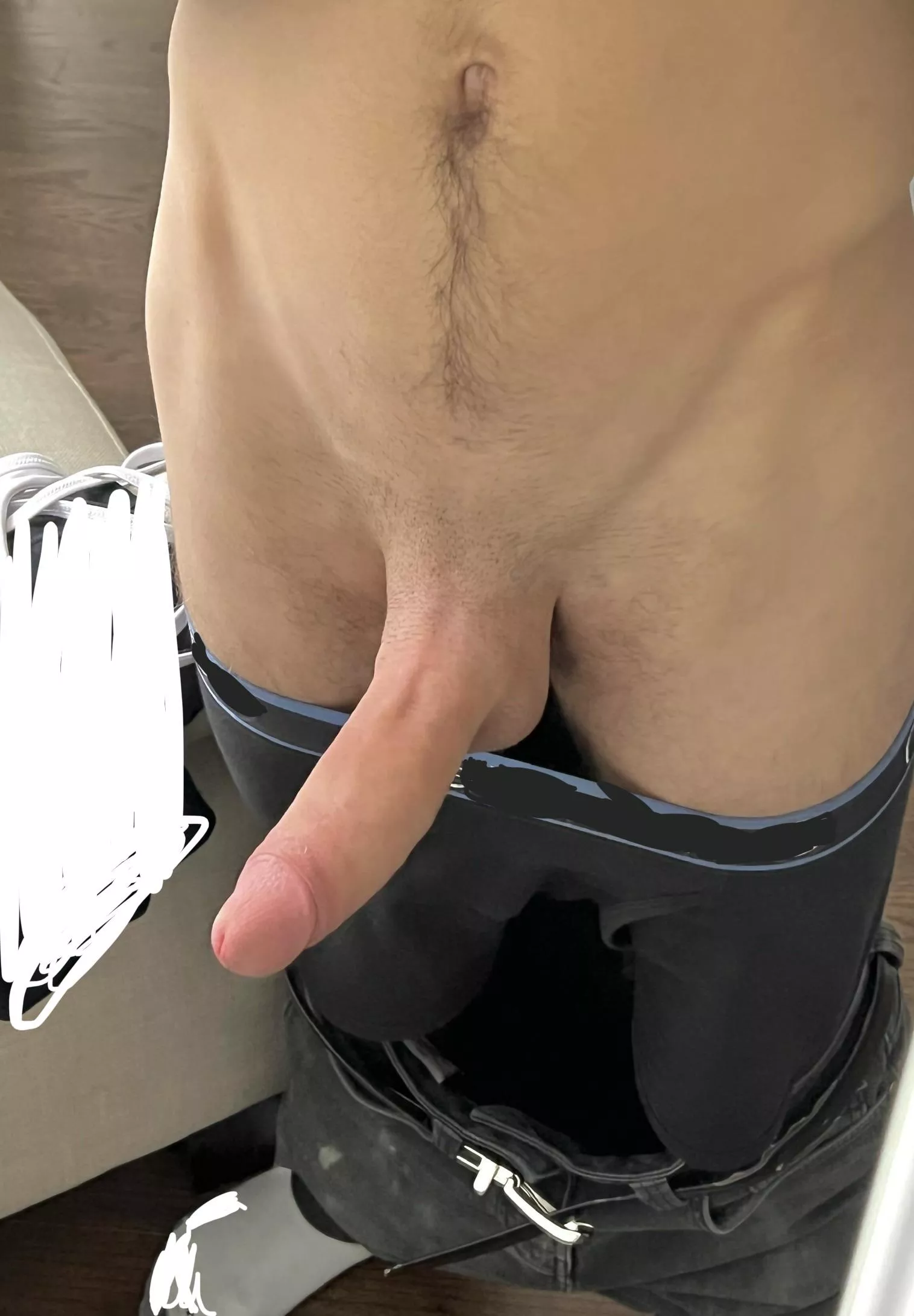 At least il have another leg if i lose one😮‍💨 posted by abigone6969