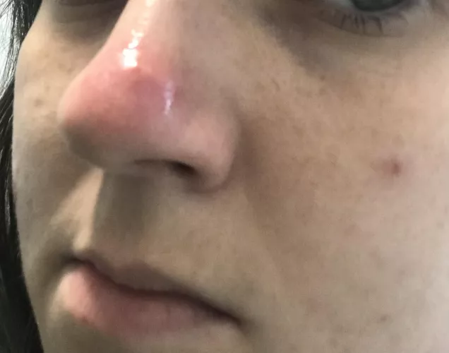 At what point do I say no bueno and go to a doctor by Psychological-Date11