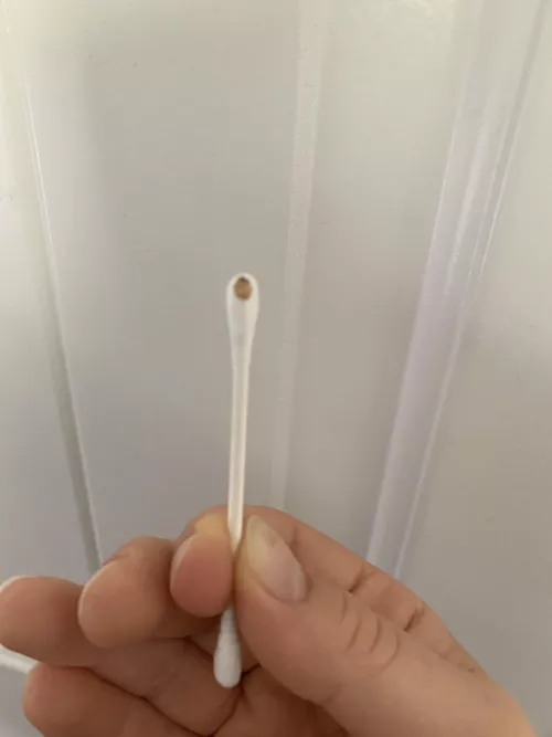 Bartholin’s Cyst...I can finally sit again! by Any_Humor2630