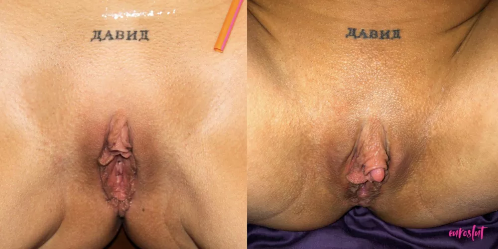 Before & after my big clit enlargement 😳 it’s still amazing to me how big I’ve managed to make my clitoris 😈 by theeuroslut