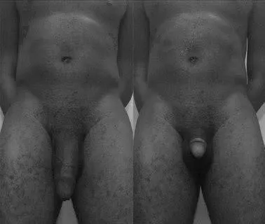 before and after posted by softemee