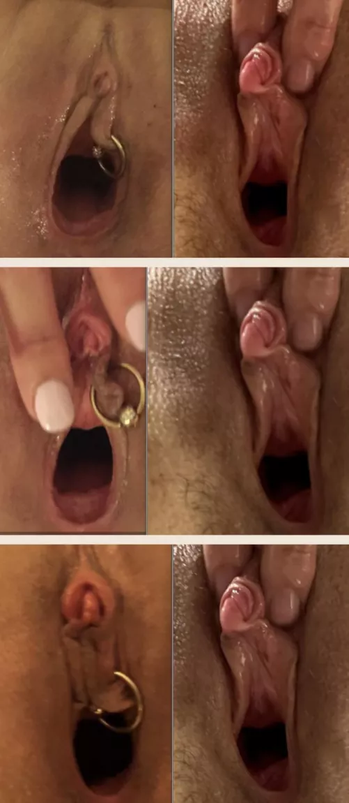 Before and after clit enlargement by Gapingsandra