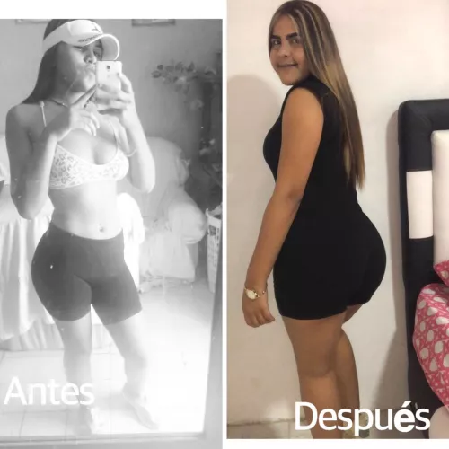 before and after 🥰 by michell25