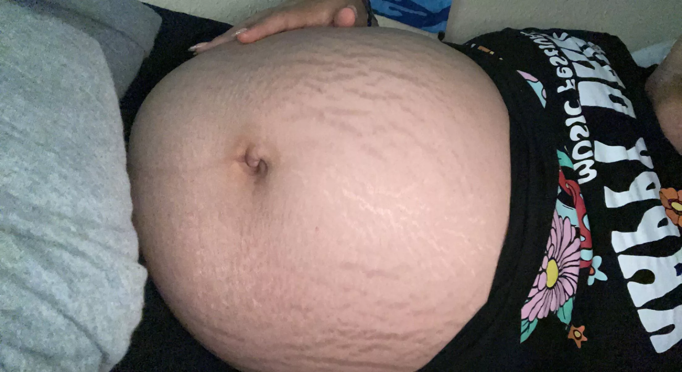 Belly button popped posted by Milkymooon66