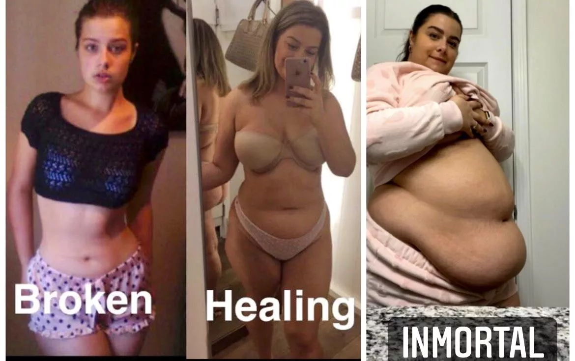 Bellyfication posted by Akatsuki11111