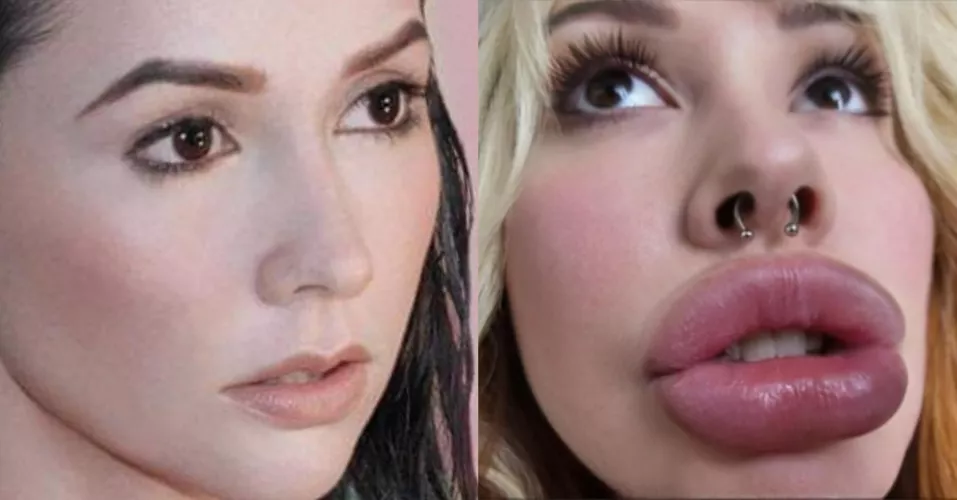 Better? 😌💕💕 by omystephaniemichelle