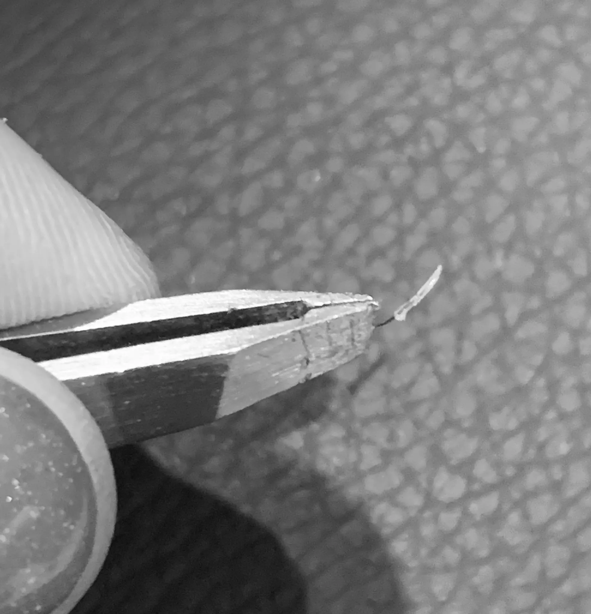 Black and white so it’s easier to see- I think this is the whole follicle? posted by Paighton_