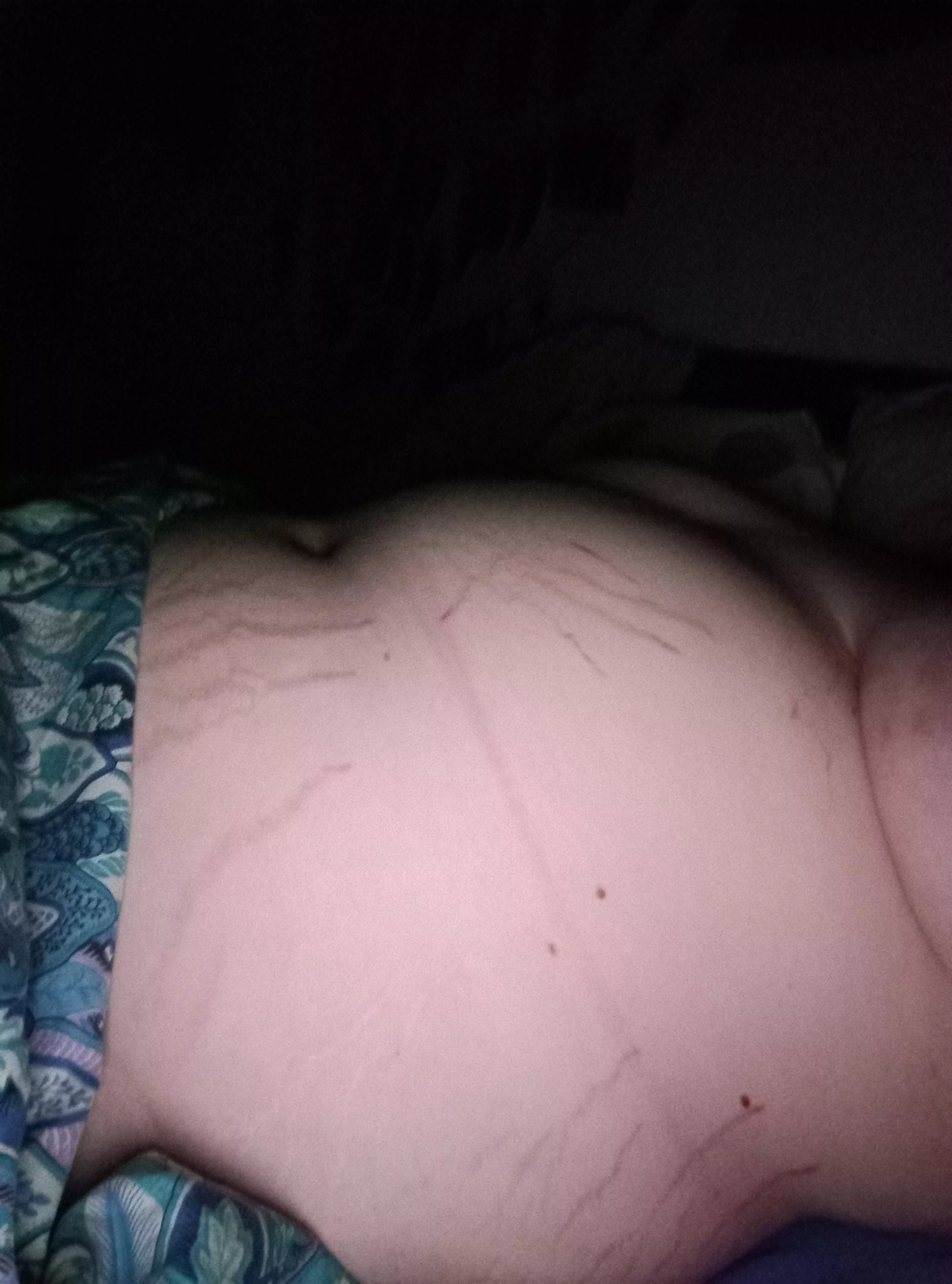 bloated + stretch marks appreciation posted by Ok-Design9124